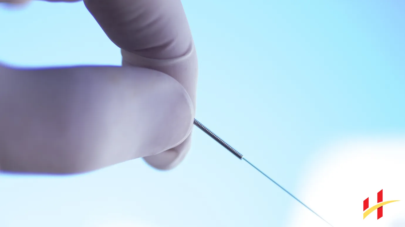 What Happens When Dry Needling Hits a Nerve