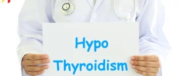 Do You Have Hypothyroidism Look at Your Hands