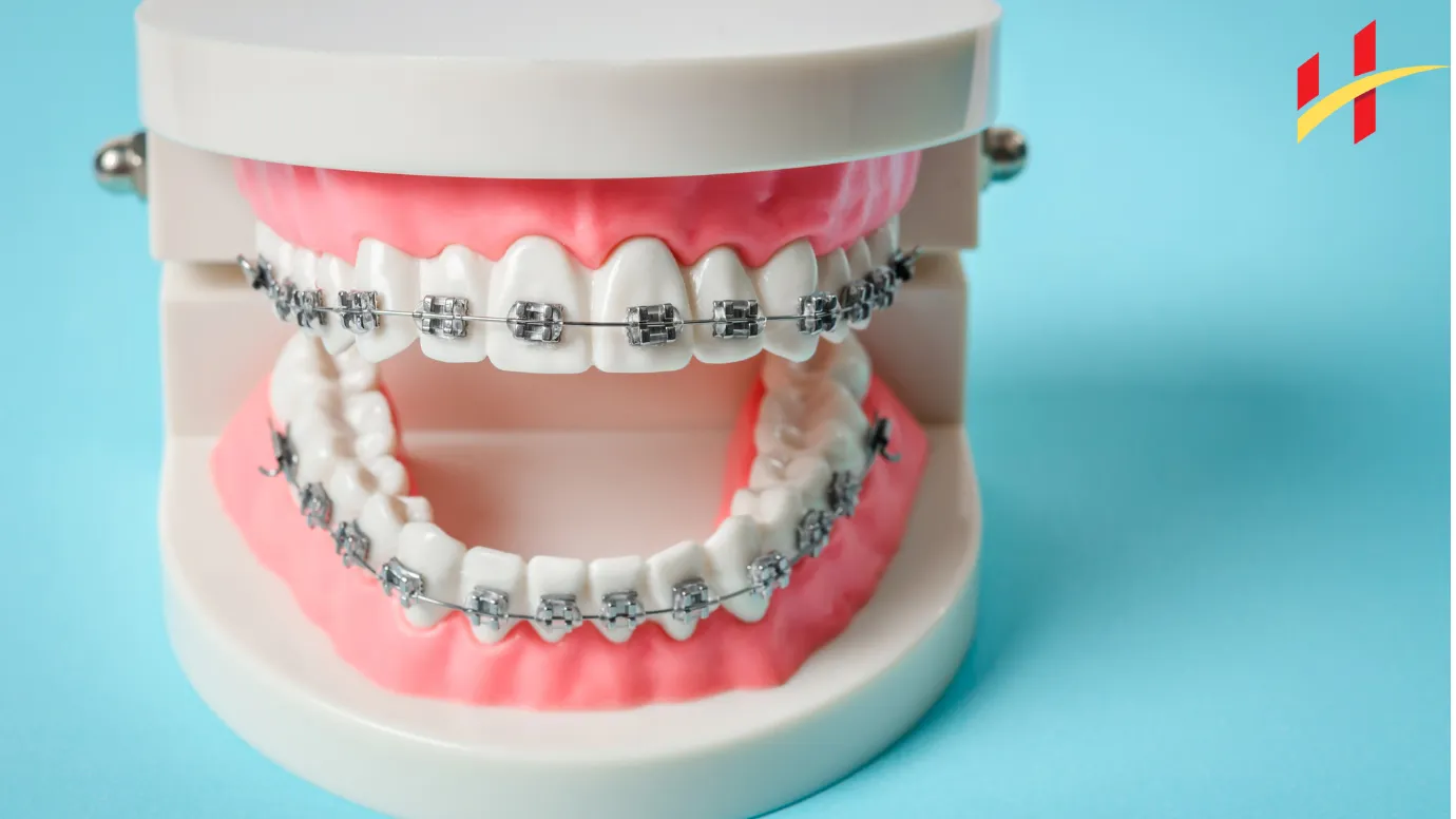 My Braces Hurt So Bad I Want to Cry