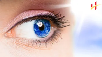 How to Remove Brown Spots in Eyes Naturally