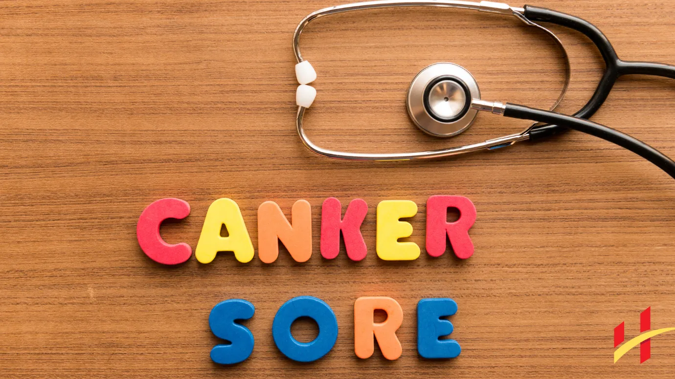 How to Get Rid of a Canker Sore in 24 Hours