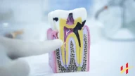 How to Stop Tooth Pain Fast