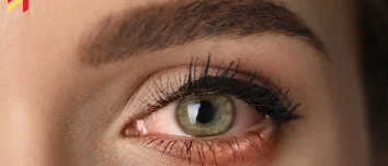 What Is Commonly Misdiagnosed as Pink Eye