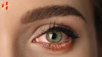 What Is Commonly Misdiagnosed as Pink Eye