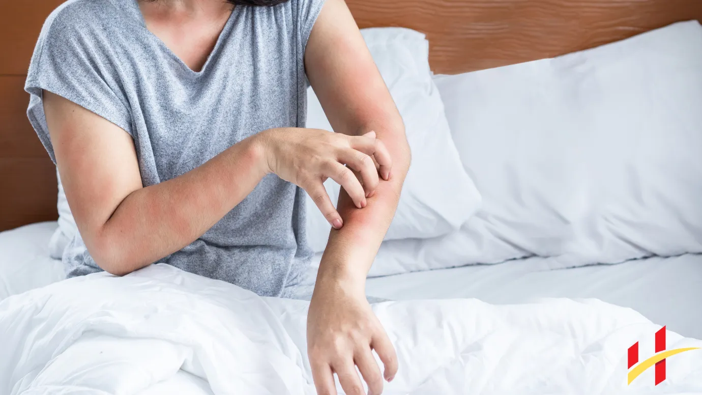 Bed Bug Flea Bites on Humans