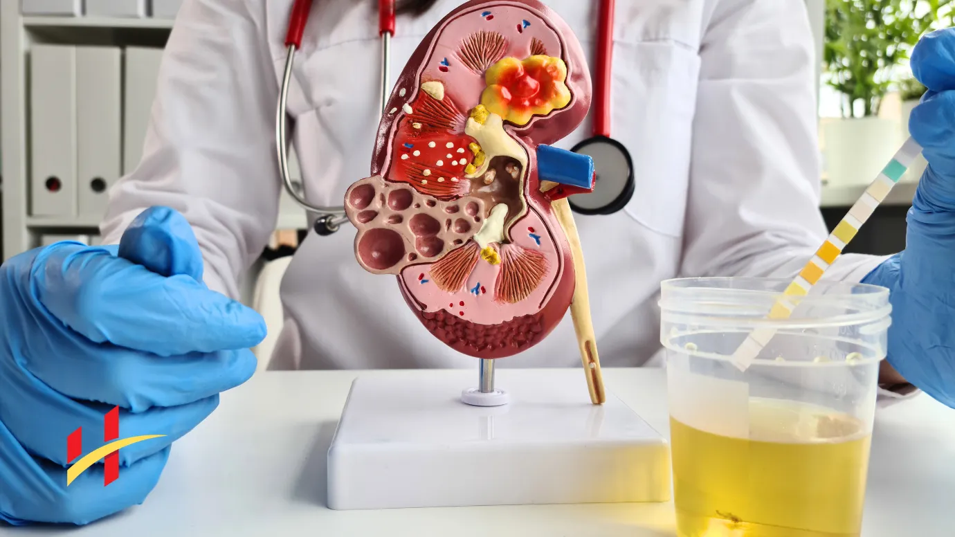 Leukocytes in Urine - Treatment, and More