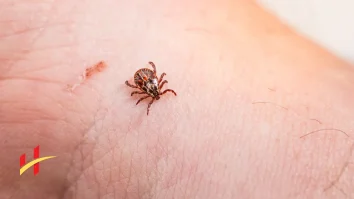 What Does a Tick Bite Look Like?