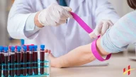 Mpv in Blood Test