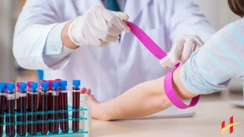 Mpv in Blood Test