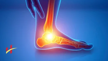 Pain on Top of the Foot Causes and Treatment